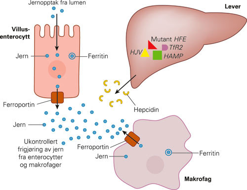 Figur 6  Jernstoffskiftet ved HFE-hemokromatose. Eksporten av jern fra enterocytter og makrofager til plasma er ukontrollert