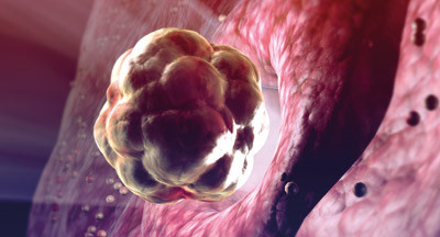 Illustrasjonsfoto &copy; MedicalRF com/GV-Press/NordicPhotos