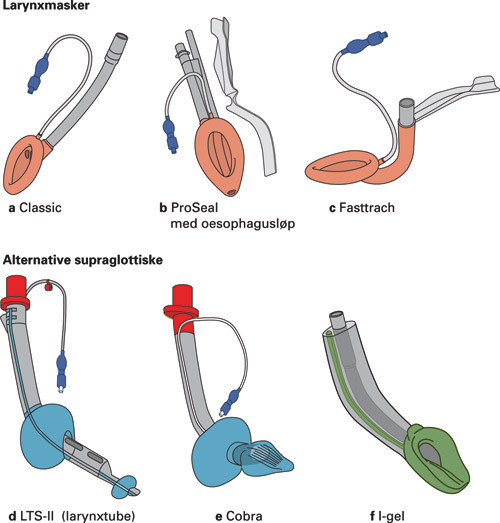 Figur 3  Larynxmasker og alternativt supraglottisk utstyr. a) Classic larynxmaske uten oesophagusl&oslash;p. b) ProSeal larynxmaske&hellip;