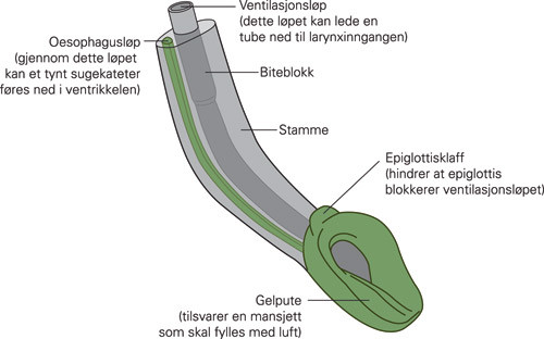 Figur 4  Detalj av I-gel larynxtube. Gjennom ventilasjonsl&oslash;pet kan man lede en tube ned til larynxinngangen&hellip;