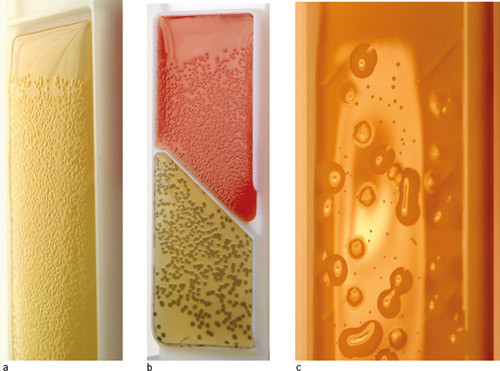 Figur 1  Eksempel p&aring; en inkubert urindyppekultur (Uricult Trio). Legg merke til at det skal gjenst&aring; et &laquo;udyppet&raquo; felt &oslash;verst&hellip;