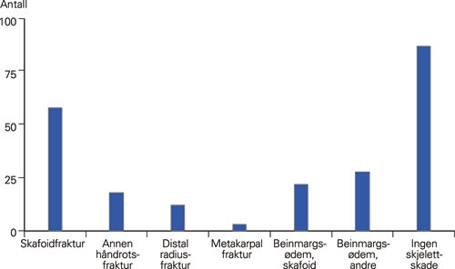 Figur 2  MR-funn hos 228 av 444 pasienter som ble gipset p&aring; klinisk mistanke om skafoidfraktur ved Oslo skadelegevakt i&hellip;