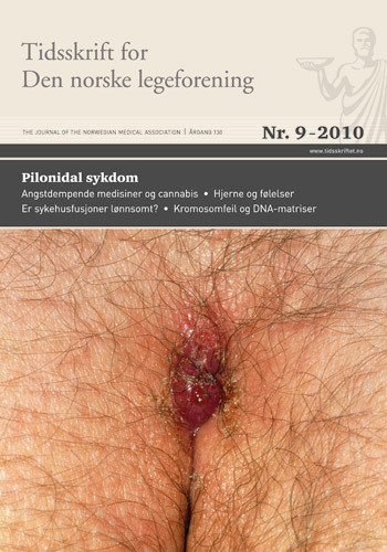Pilonidal sykdom. Illustrasjonsfoto Science Photo Library/GV-Press/NordicPhotos