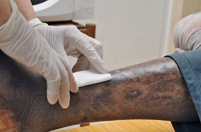 Illustrasjonsfoto &copy; Aubert/BSIP/GV-Press/NordicPhotos