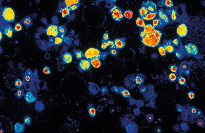 Transmisjonselektronmikroskopisk bilde av cytomegalovirus. Illustrasjonsfoto &copy; Scott Camazine/Photo Researchers/GV-Press&hellip;