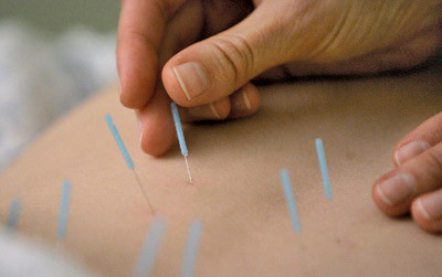 Illustrasjonsfoto &copy; M. Spencer Green/AP Photo/SCANPIX