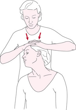 Figur 1  Spurlings test. Ekstensjon i nakken, lateralfleksjon og rotasjon mot aktuell side kombinert med aksialt trykk vil&hellip;