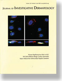 Artikkelen ble e-publisert 16.9. 2010 i tidsskriftet Journal of Investigative Dermatology (www.nature.com/jid) som er det&hellip;