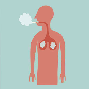 Illustrasjon Istockphoto