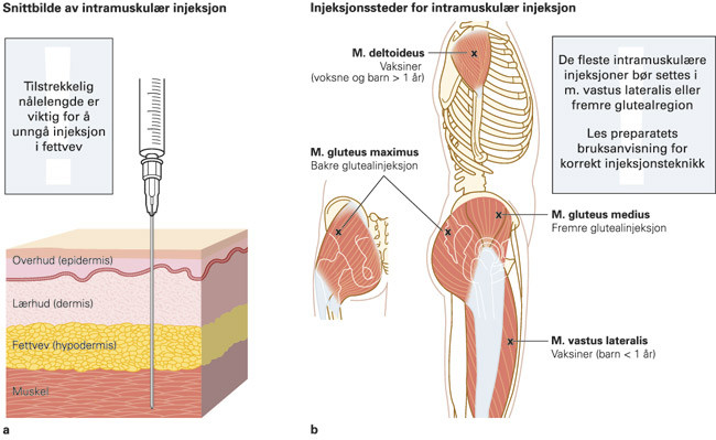 Figur 1  a) Ved intramuskul&aelig;r injeksjon m&aring; n&aring;len v&aelig;re lang nok. b) Valg av injeksjonssted er viktig