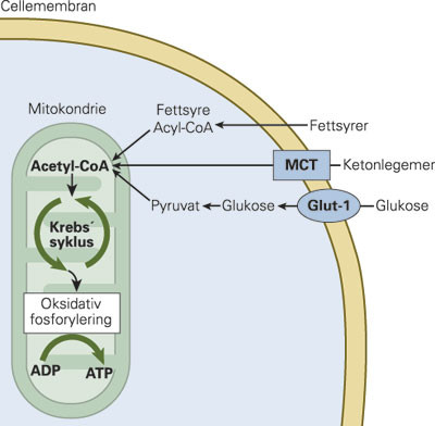 Figur 1 Ved normal GLUT-1-funksjon er det glukose som er hjernens hovedenergikilde, og det er da glukosetransportprotein&hellip;
