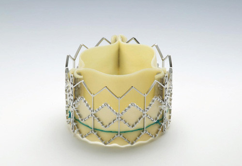 Figur 1  Transkateter hjerteklaff, ballongekspanderbar, Edwards SAPIEN. Gjengitt med tillatelse fra produsenten