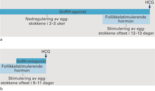 Figur 1  Sammenlikning av behandlingsvarighet f&oslash;r egguttak ved a) tradisjonell behandling med GnRH-agonist og b) bruk av&hellip;
