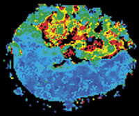 Illustrasjonsfoto Istockphoto