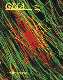 Artikkelen ble publisert i augustnummeret 2010 av tidsskriftet Glia (www.wiley.com/bw/journal.asp?ref=0894-1491&site=1).