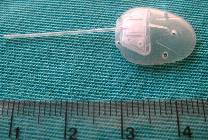 Silikonventilen. Foto Jon Slettedal