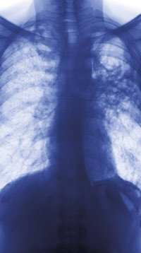 Illustrasjonsfoto Sciencephoto/SCANPIX