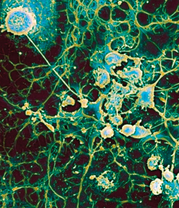 Illustrasjonsfoto Science Photo/SCANPIX