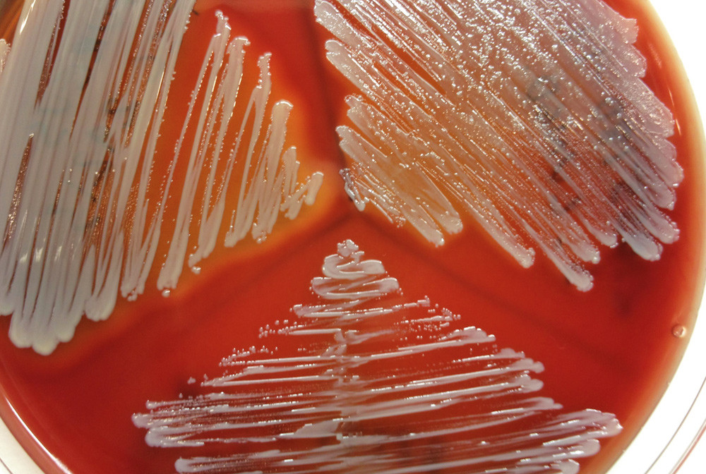 Figur 1  Tre ulike stafylokokkstammer s&aring;dd ut p&aring; samme agar: S aureus (oppe til venstre), S lugdunensis (oppe til h&oslash;yre) og&hellip;