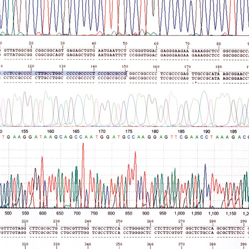 Illustrasjonsfoto Sciencephoto/Scanpix