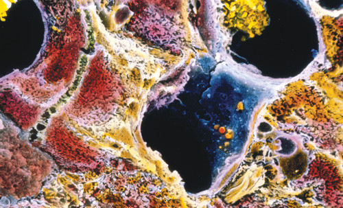 Illustrasjonsfoto Science Photo Library/NTB scanpix