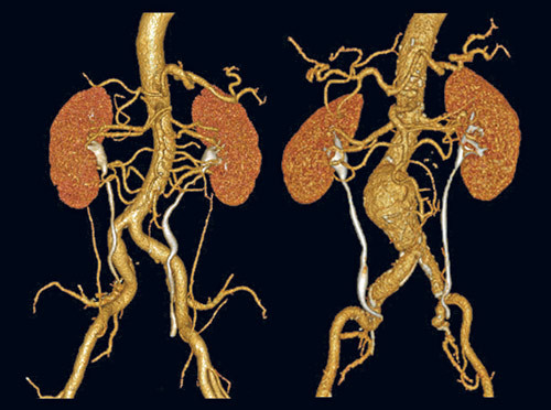 Illustrasjonsfoto Science Photo Library/NTB scanpix
