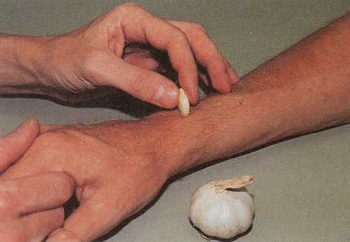 Figur 8  En av forfatterne gjorde tjeneste som &aring;te. Den ene h&aring;nden ble grundig innsmurt med hvitl&oslash;k, den andre var helt ren