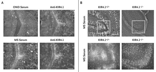 Gjengitt med tillatelse fra New England Journal of Medicine (1)