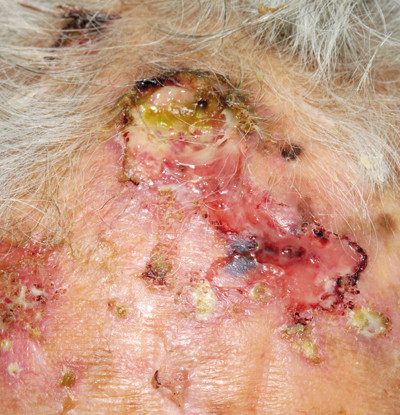 Illustrasjonsfoto Science Photo Library/NTB scanpix