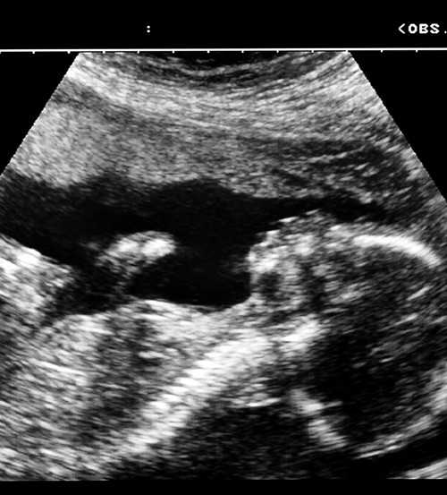 Illustrasjonsfoto Science Photo Library/NTB scanpix