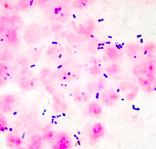 Illustrasjonsfoto Science Photo Library/NTB scanpix