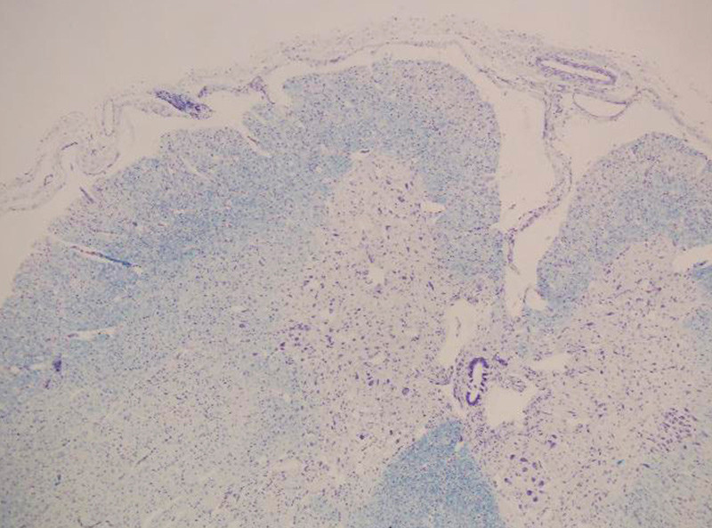 Figur 2  Medulla spinalis, tynn fremre rot (oppe til venstre). Foto David Scheie