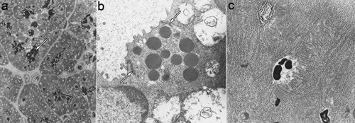 Figur 1  Forandringer i eksokrine pancreasceller hos en 56 dager gammel hyperlipemisk mink som var klinisk frisk og uten&hellip;