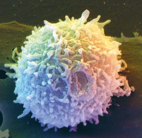 Illustrasjonsfoto Science Photo/NTB scanpix