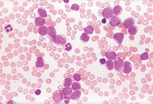 Illustrasjonsfoto Science Photo Library/NTB scanpix