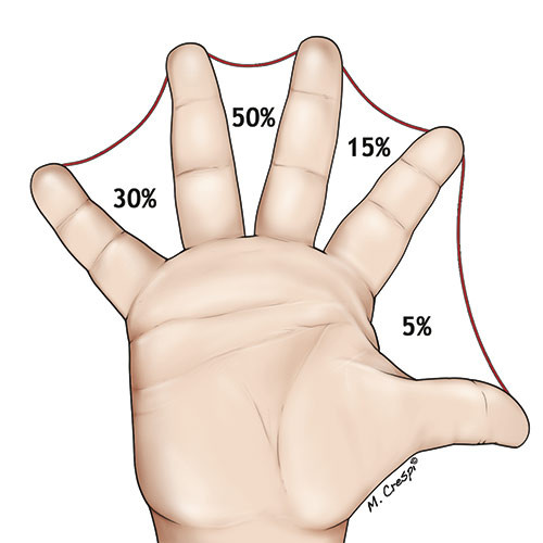 Figur 1  Skjematisk fremstilling av involverte mellomrom mellom fingrene (web) (8)