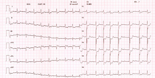 Illustrasjonsfoto Science Photo Library/NTB scanpix
