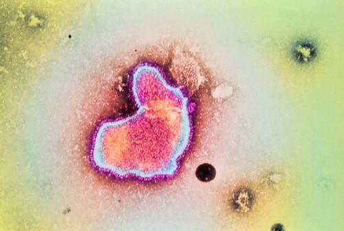 Illustrasjonsfoto Science Photo Library/NTB scanpix