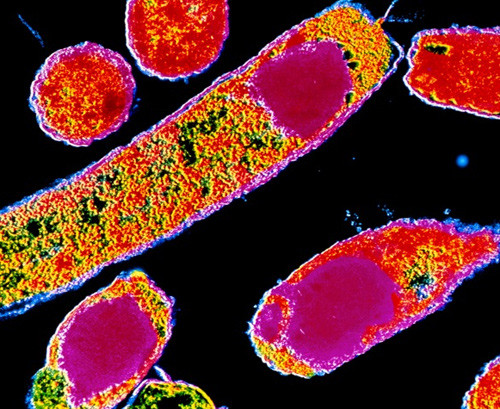 E. coli. Science photo/NTB scanpix