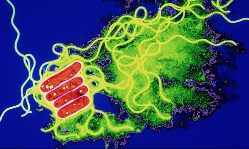 Illustrasjonsfoto Science Photo Library/NTB scanpix