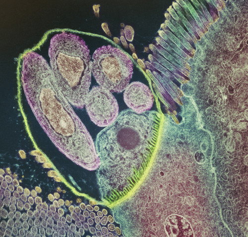 Science Photo Library/NTB scanpix