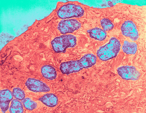 Illustrasjonsfoto Science Photo Library/NTB scanpix