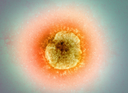 Illustrasjonsfoto Sciencephoto/NTB scanpix