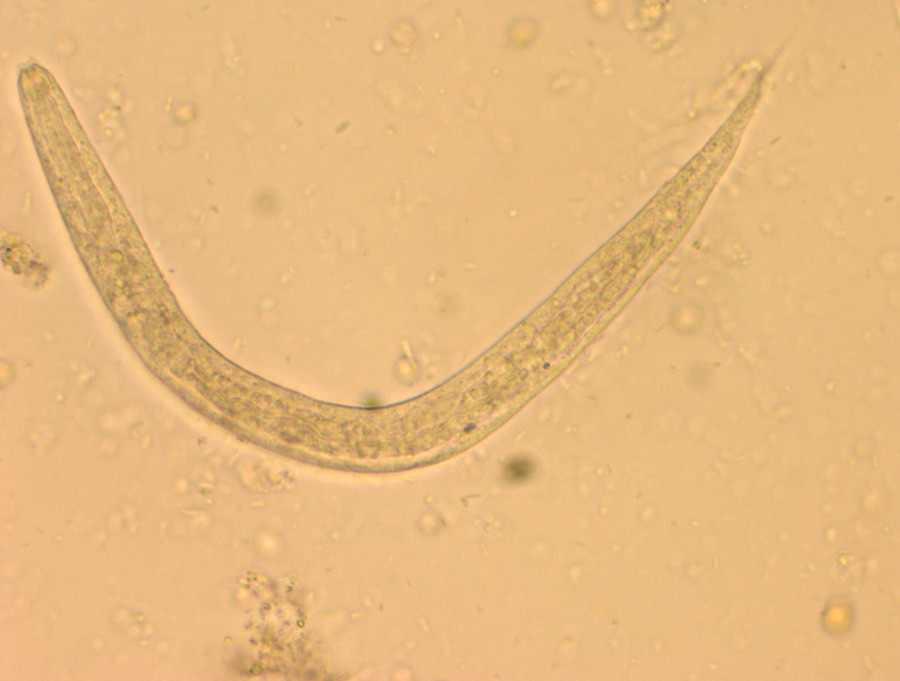 Figur 1Strongyloides stercoralis i avf&oslash;ringspr&oslash;ven. Foto: Avdeling for mikrobiologi og smittevern, Akershus&hellip;