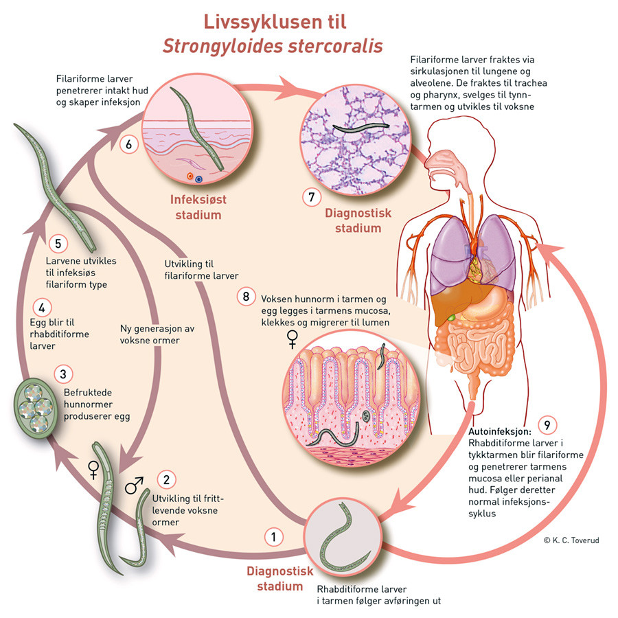 Figur 2 Livssyklusen til parasitten Strongyloides stercoralis. Bearbeidet og gjengitt med tillatelse fra Centers for Disease&hellip;