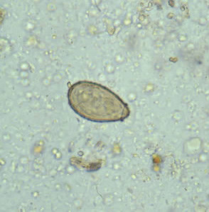 Figur 2  Clonorchis sinensis-egg. En liten typisk utvekst er synlig p&aring; den bredere enden av egget. Gjengitt med tillatelse&hellip;