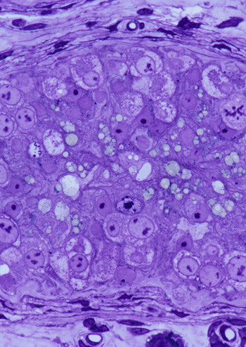 Illustrasjonsfoto: Science Photo Library/NTB scanpix