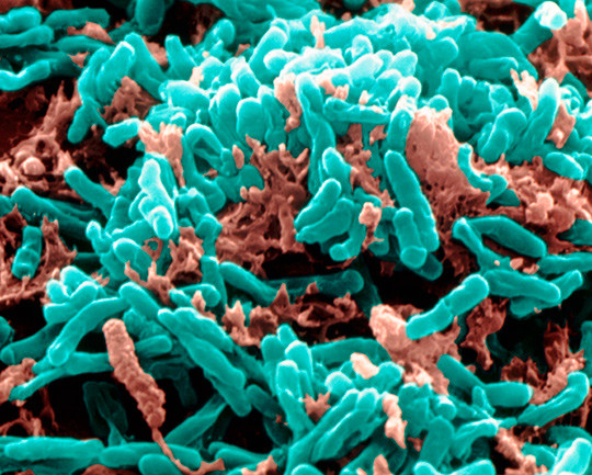 Illustrasjonsfoto: Science Photo Library/NTB scanpix