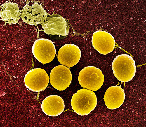 Illustrasjonsfoto: Sciencephoto/NTB scanpix