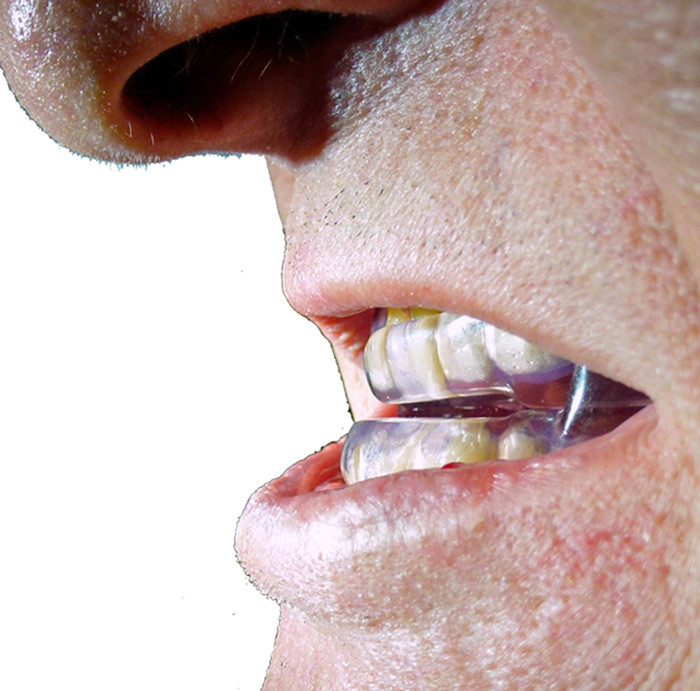 En av de vanligste type skinner som anvendes ved behandling av s&oslash;vnapn&eacute;. Foto: Privat